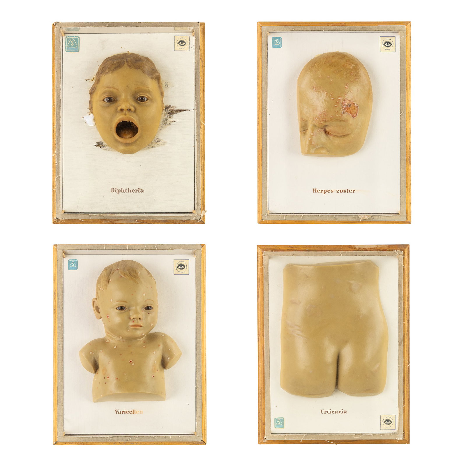 A Collection of four wax diagnostic models for childhood diseases, Deutsches Hygiene-Museum Dresden, (1 of 14)