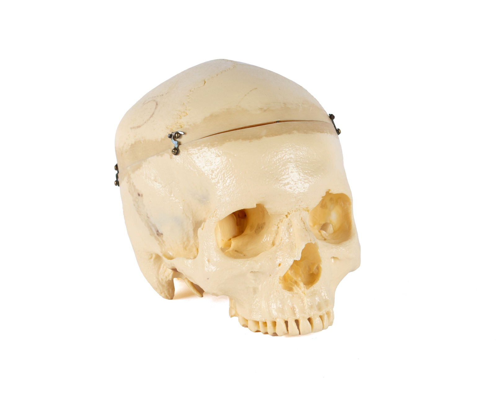 ANATOMICAL SKULL MODEL (1 of 5)