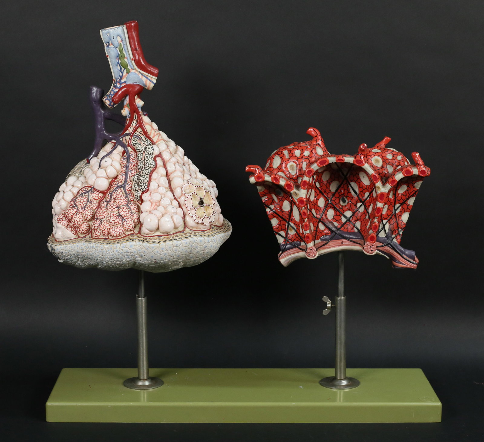 Somso Anatomical Model Lungs & Alveoli (1 of 11)