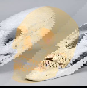Medical Human Skull Specimen: Human skull specimen, with spring articulated jaw. 8"L x 5 3/4"H. As