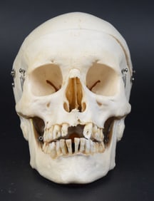 Medical Human Skull Specimen