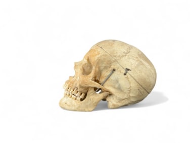 Antique Medical Human Scull