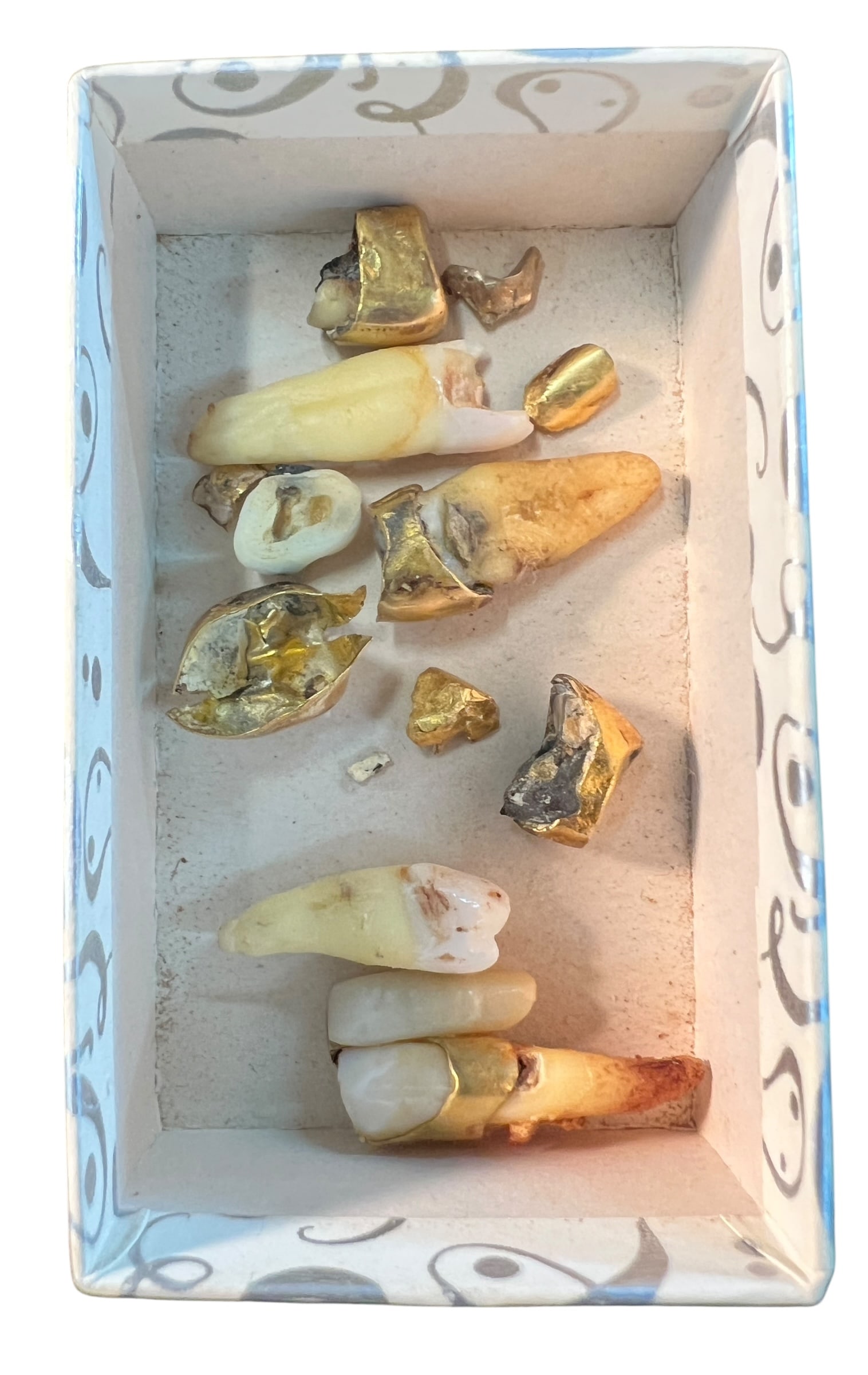 Collection of Dental Gold and Teeth: TW of gold AND teeth 12 grams