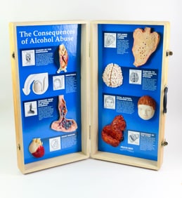 Portable Alcohol Abuse Display