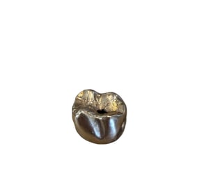 10K, 14K, 18K ? gold tooth cap