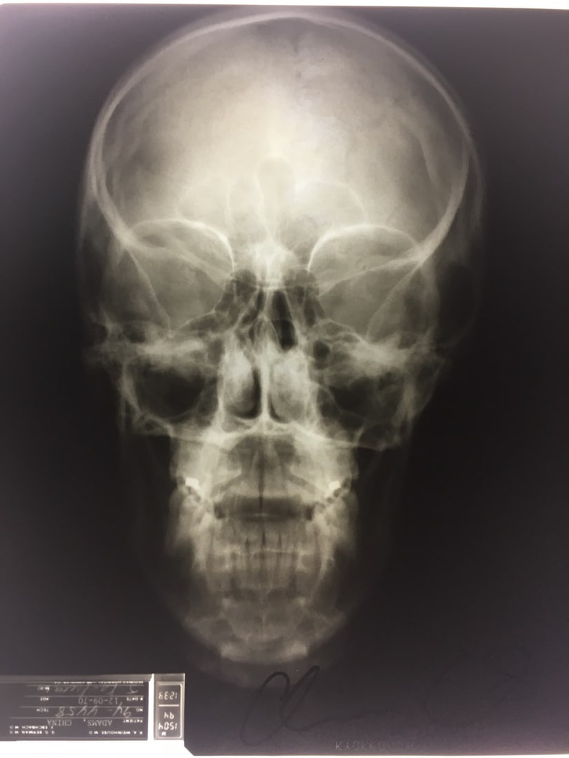 China Adams - X-Ray, Light Box, Ink on Paper, 'Contract of Sale: Skull' (1 of 1)