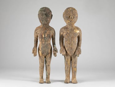 A pair of figures with copper gilded needle moxibustion in the Han Dynasty