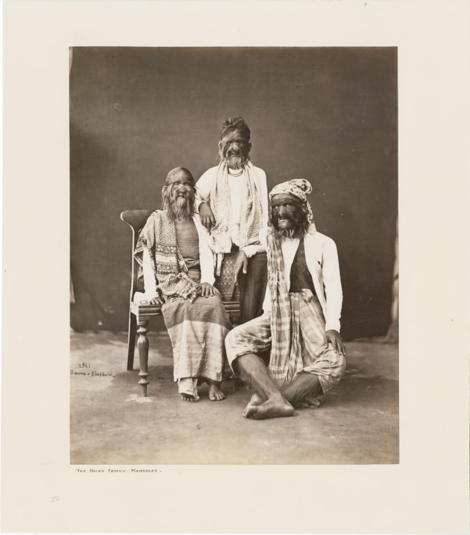 BOURNE & SHEPHERD. HAIRY FAMILY. MANDALAY: Bourne & Shepherd. 2361. THE HAIRY FAMILY. MANDALAY. Mounted, housed in frame mat. Print: 23.5 x 18.5 cm; mount: 30 x 26.5 cm; frame: 51 x 41 cm. Generally very good condition, various imperfections. 