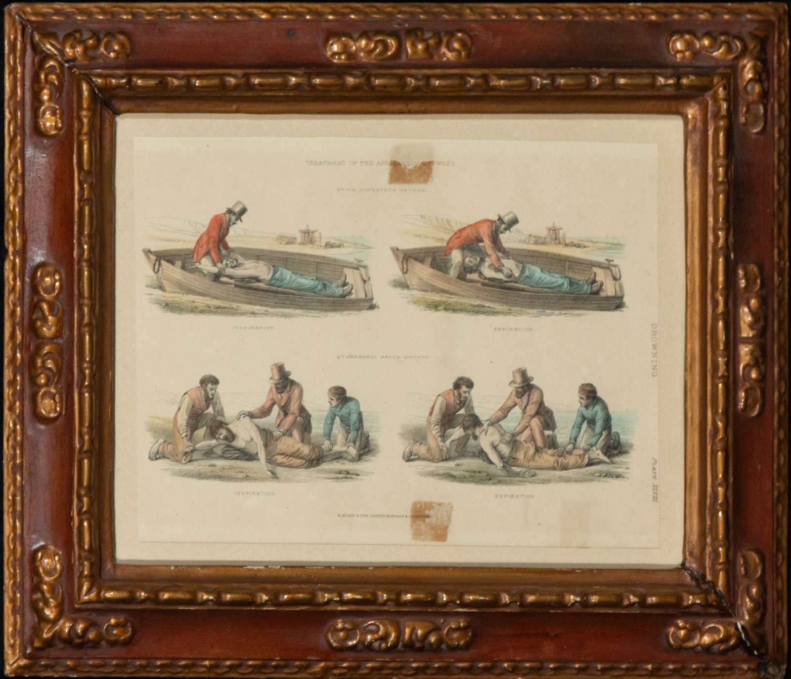 English engraving of first aid, English School, 19th Century (1 of 5)