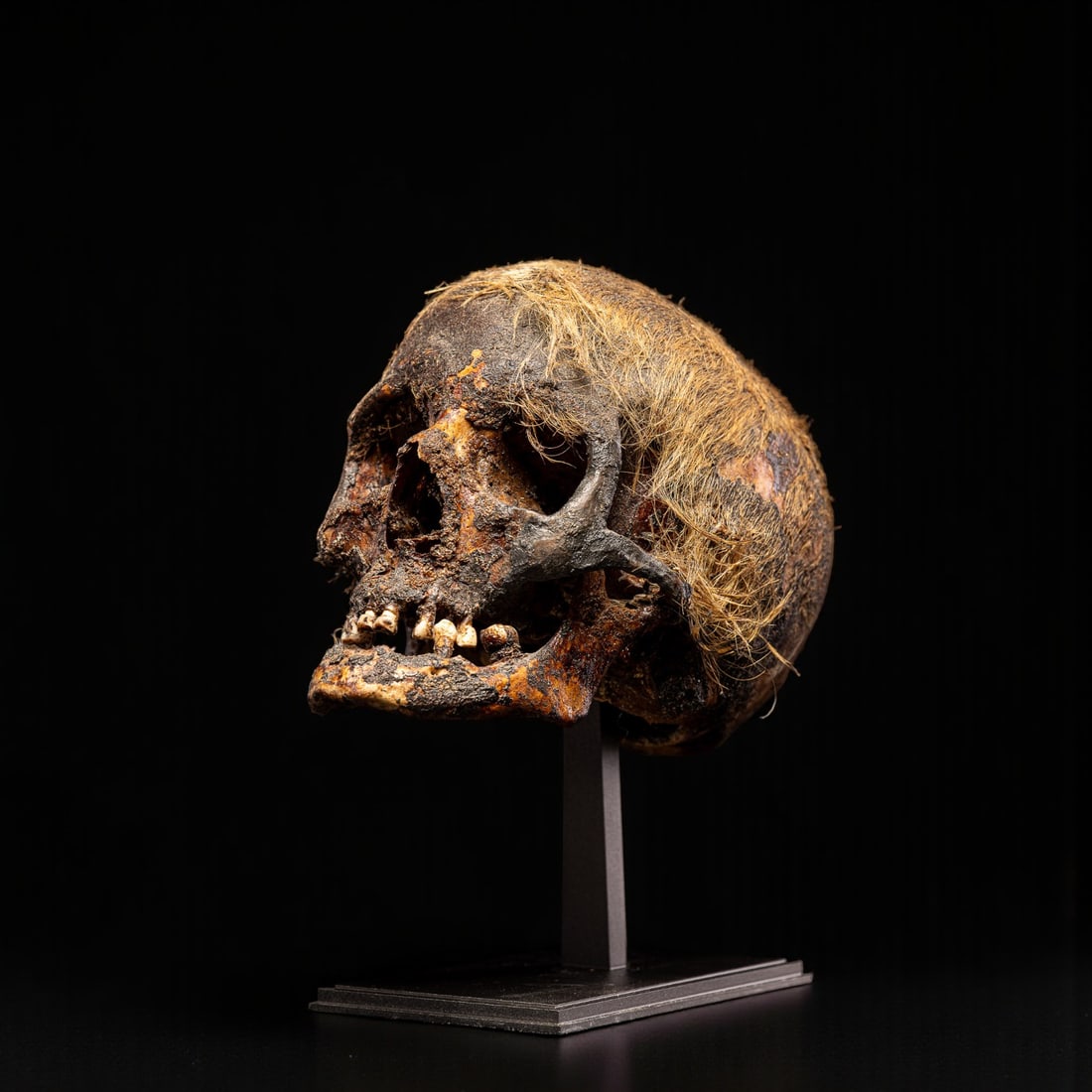 Ancient Egyptian skull with remains of hair, Roman period (1st century BC – 4th century AD): Bone. Dimensions: 20 × 22 × 14 cm. A rare and fascinating example of human remains from Roman Egypt, still preserving traces of original hair. This type of find is frequently associated with the fun
