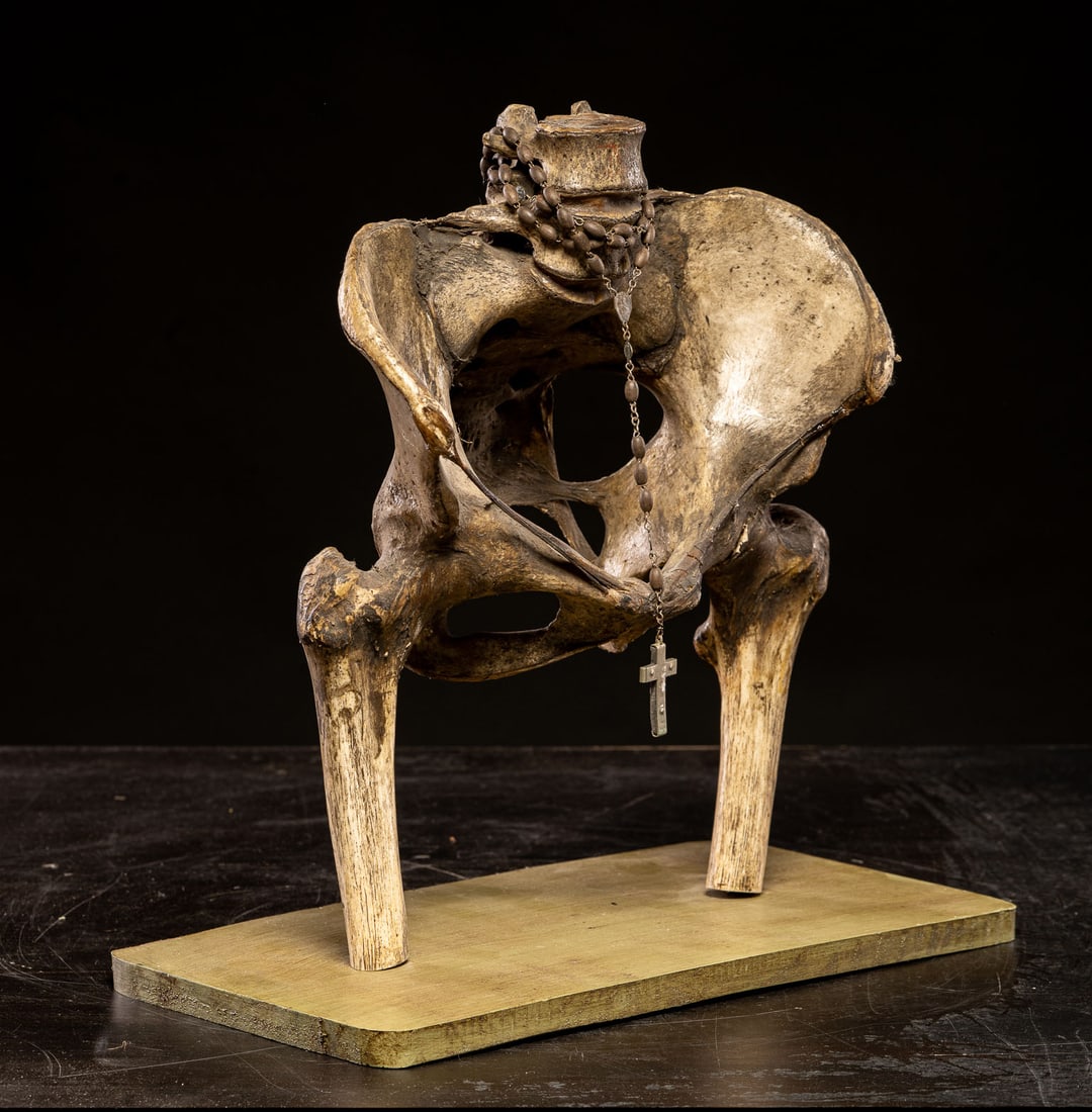 Human pelvis for educational purposes, Europe, late 19th - early 20th century: Organic material and wood. Dimensions: 34 x 28 x 12 cm. An interesting anatomical and educational piece consisting of a human pelvis mounted on a base, complemented by skeletal elements arranged in an