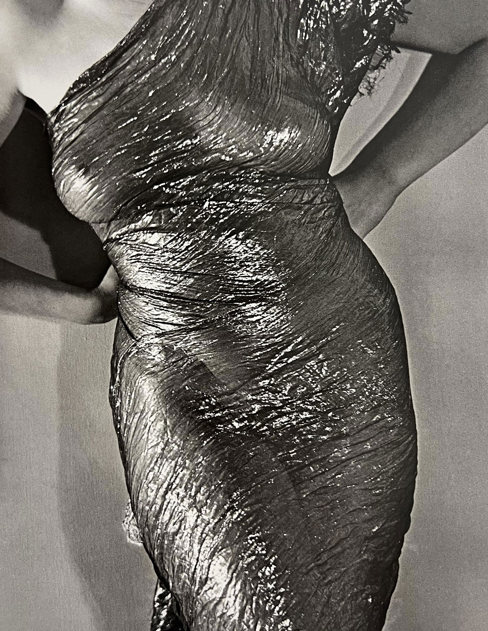 Man Ray, Anatomies, C.1930, (1 of 1)