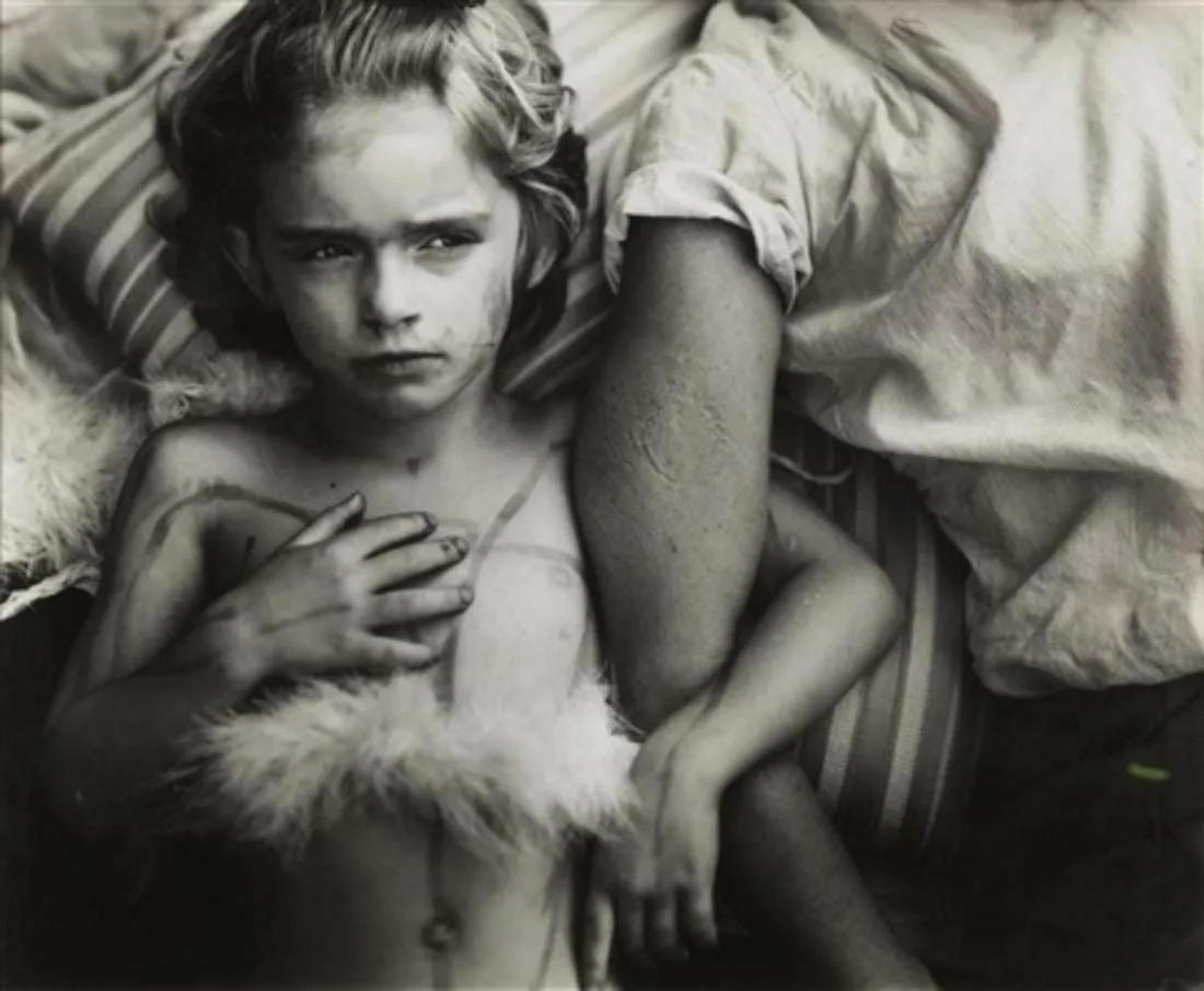 SALLY MANN - Jessie bites, 1985: Photographer: Sally Mann is an American photographer, widely known for her large-format, black-and-white photographs - at first of her young children, then later of landscapes suggesting decay and dea