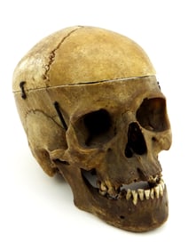 Rare Old Real Human Skull
