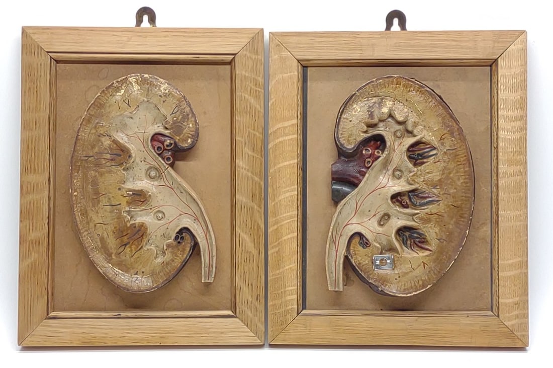 Pair of Vintage Anatomical Kidney Models (1 of 5)