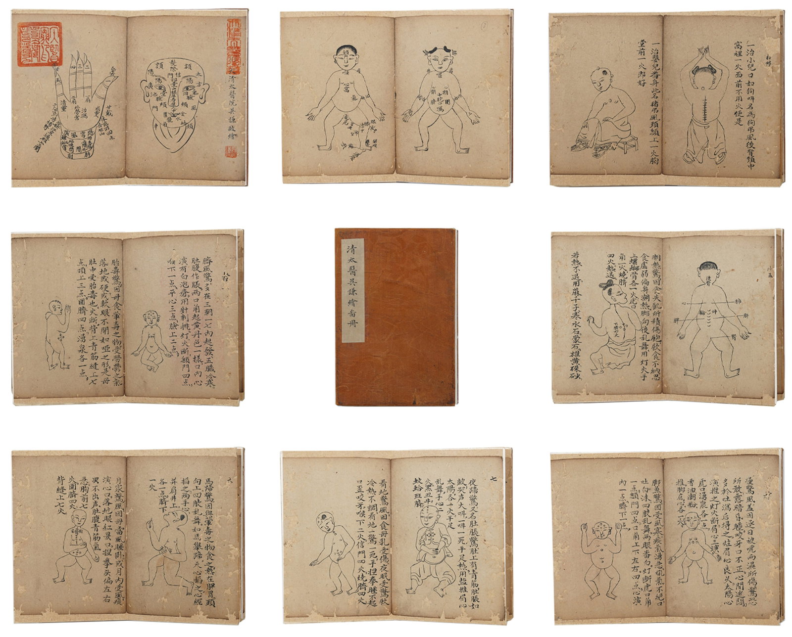 A MEDICAL BOOK ALBUM LEAVES ON PAPER BY WU QIAN.吳謙: Medical Book Album Leaves on Paper by Wu Qian.吳謙