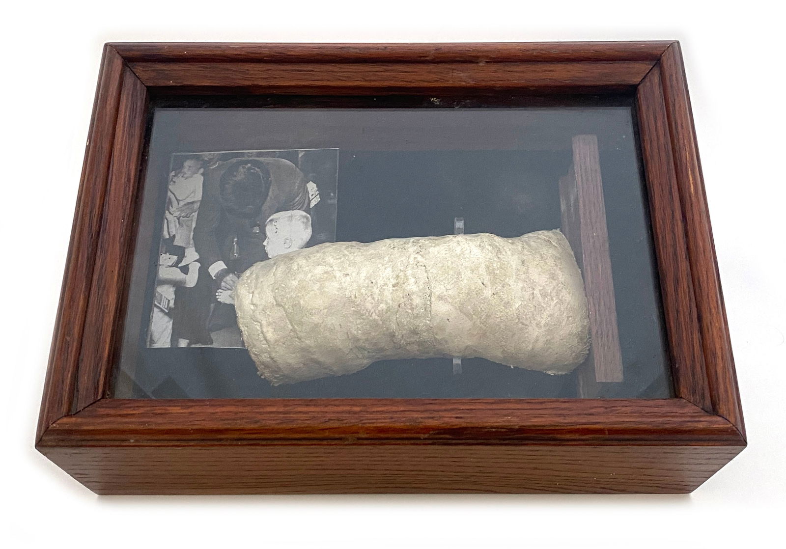 John F. Kennedy – Autographed Plaster Arm Cast as U.S. Senator – 1958 Campaign Artifact - 2