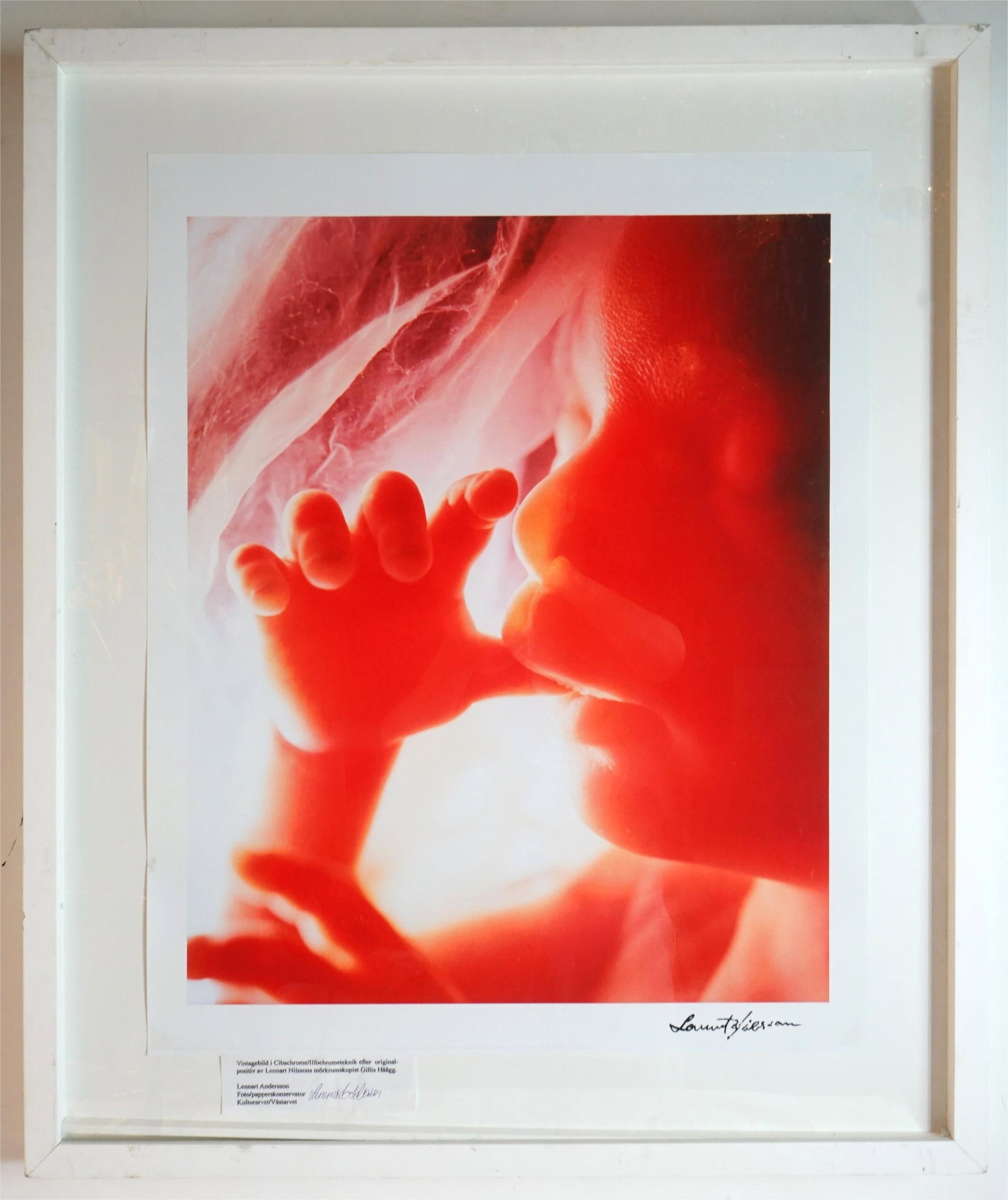 "Tumsugarenur"Ur "Ett Barn Blir Till"-Lennart Nilsson (Swedish, Born 1922): Approximate size:31.5x26.5in Shipping: We offer in-house shipping services for most small items. This means that we will take care of packing and shipping the items directly to you. For larger or spec