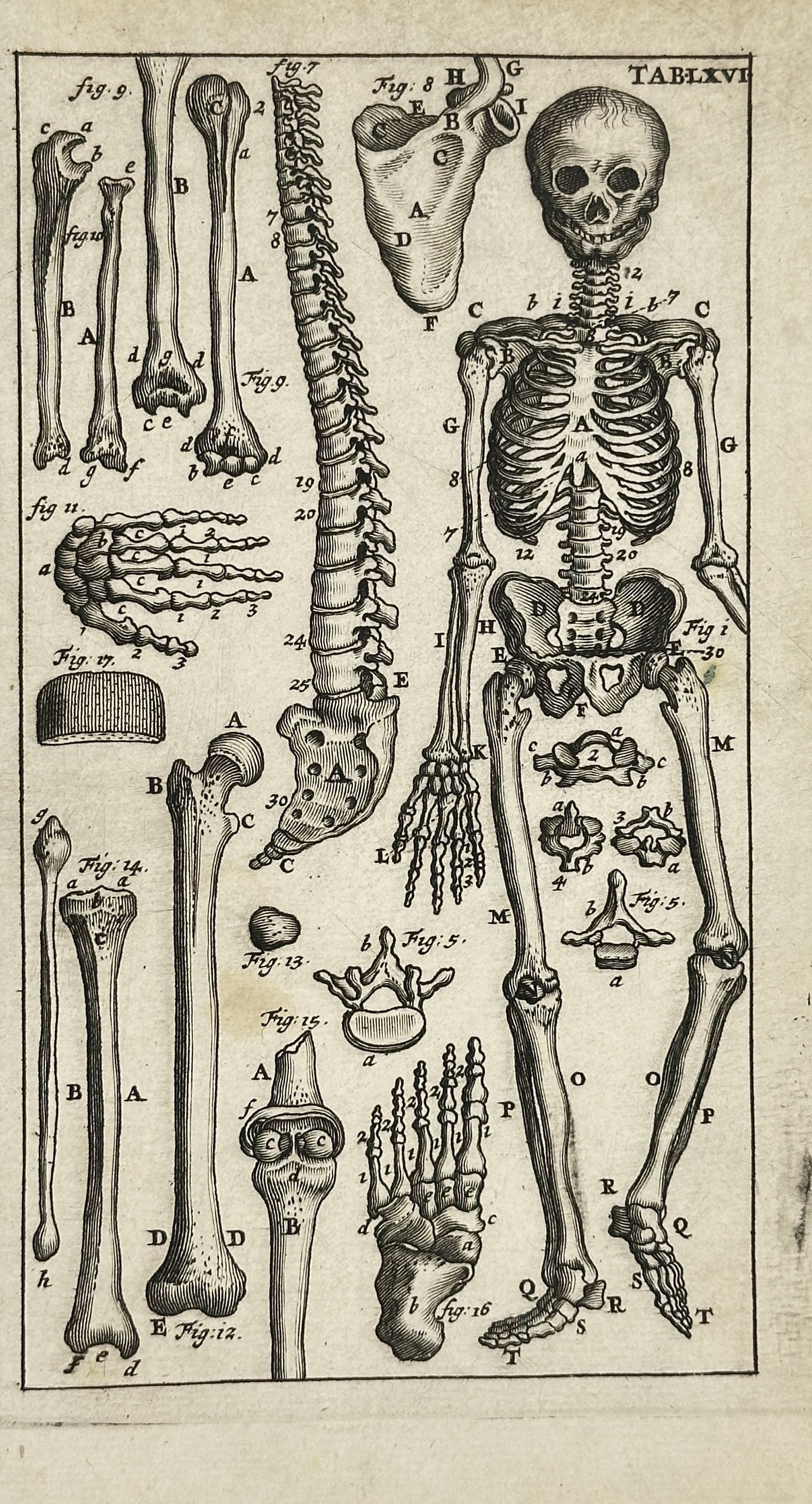 Steven Blankaart – Human Skeleton and Bones (Table LXVI) from Anatomia Reformata – Engraving: This detailed engraving, titled "TAB. LXVI." (Table 66), is taken from Steven Blankaart's significant anatomical work, "Anatomia Reformata, Sive Conformatio Corporis Humani" (Reformed Anatomy, or the 