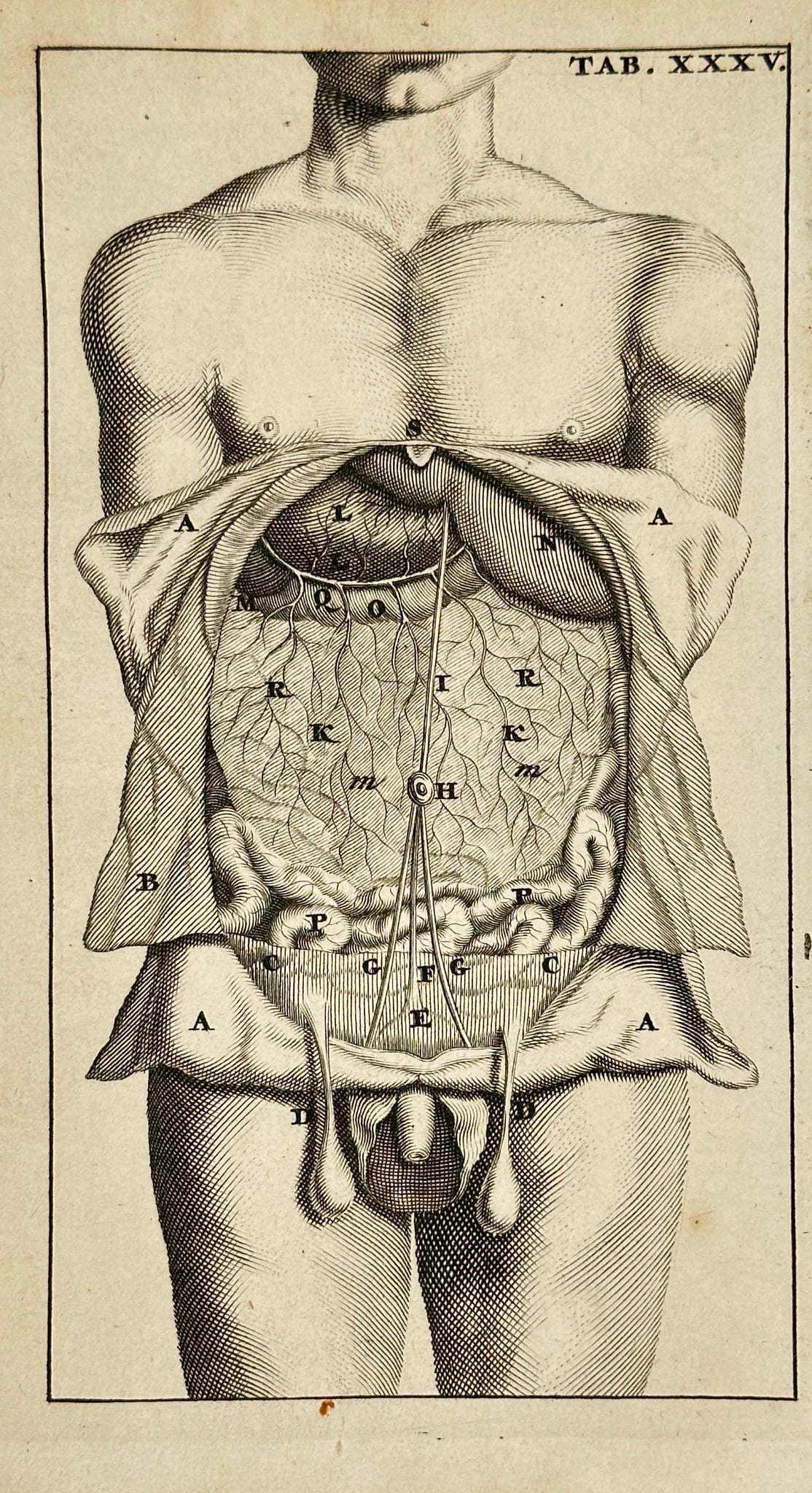 Stephanus Blankaart – Tab. XXXV (Abdominal Cavity Dissection) – Engraving: This anatomical engraving, labeled TAB. XXXV, depicts a male torso with the abdominal wall surgically opened to reveal the internal organs, including intestines, peritoneal structures, and major vascu