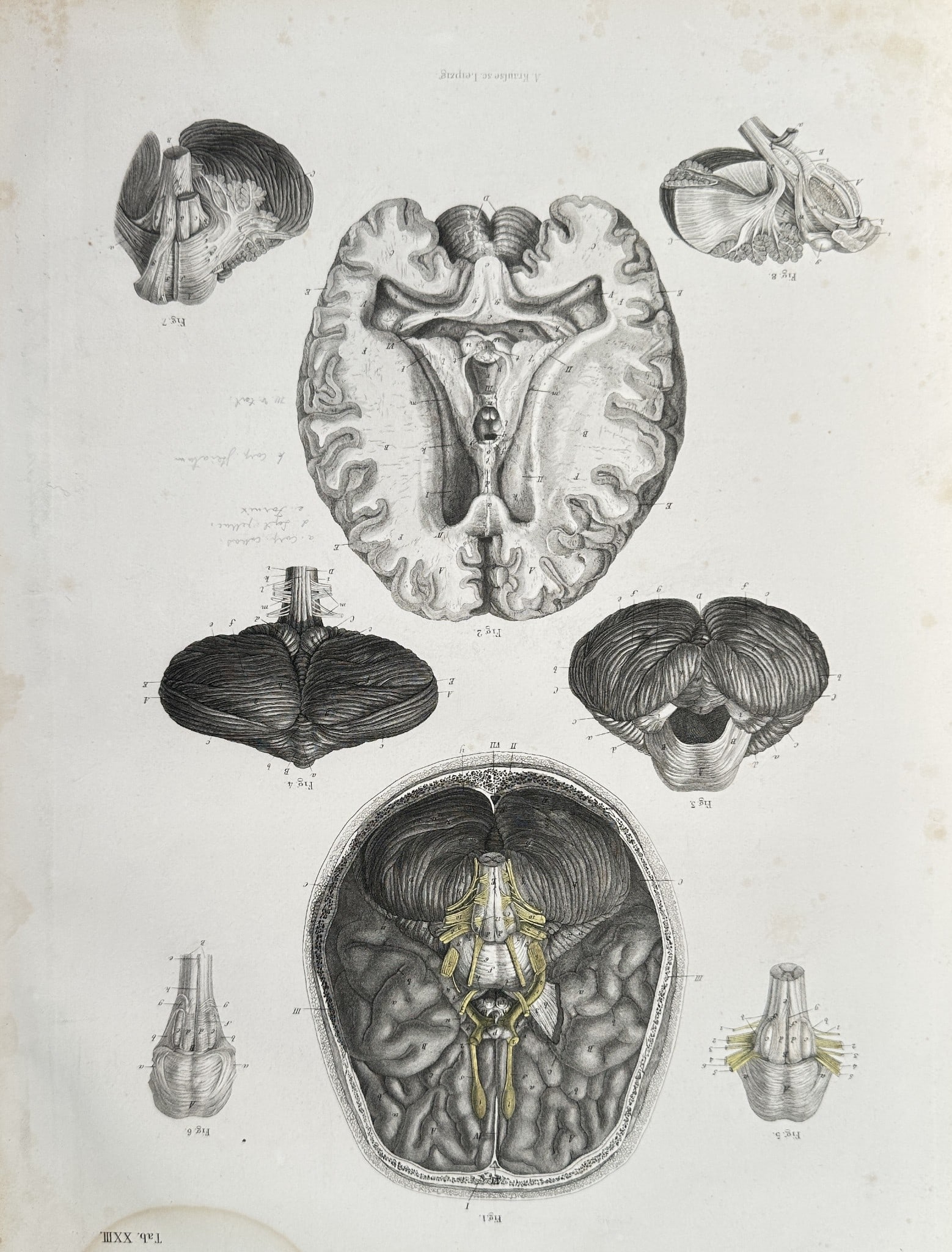 Carl Ernest Bock (1809–1874) – Dissections and Sectional Views of the Brain – Engraving: This detailed anatomical illustration provides various cross-sectional and dissected views of the human brain. The main figures include a superior transverse section of the cerebrum showing the intern