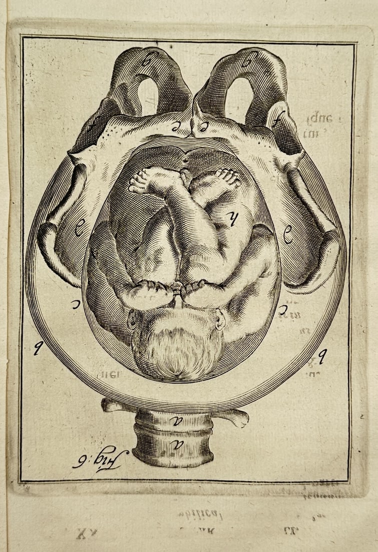 Hendrik van Deventer (1657–1724) – Anatomical Illustration of the Fetus in Utero: This anatomical engraving is a detailed scientific illustration central to the study of obstetrics. It depicts a fetus positioned within the uterus and seated in the female pelvis. The illustration is
