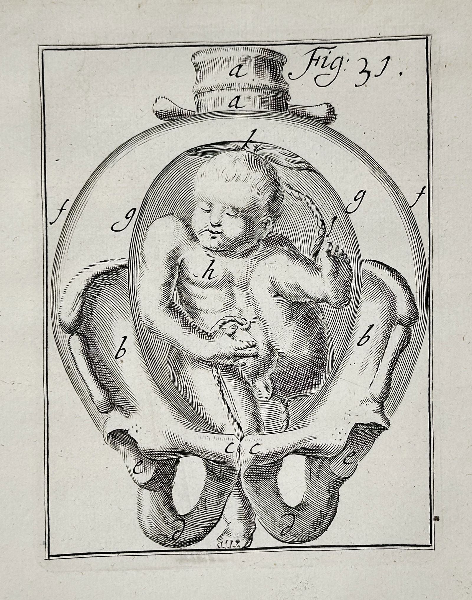 Hendrik van Deventer (1657–1724) – Anatomical Study of a Fetus in the Pelvis – Engraving (1 of 3)