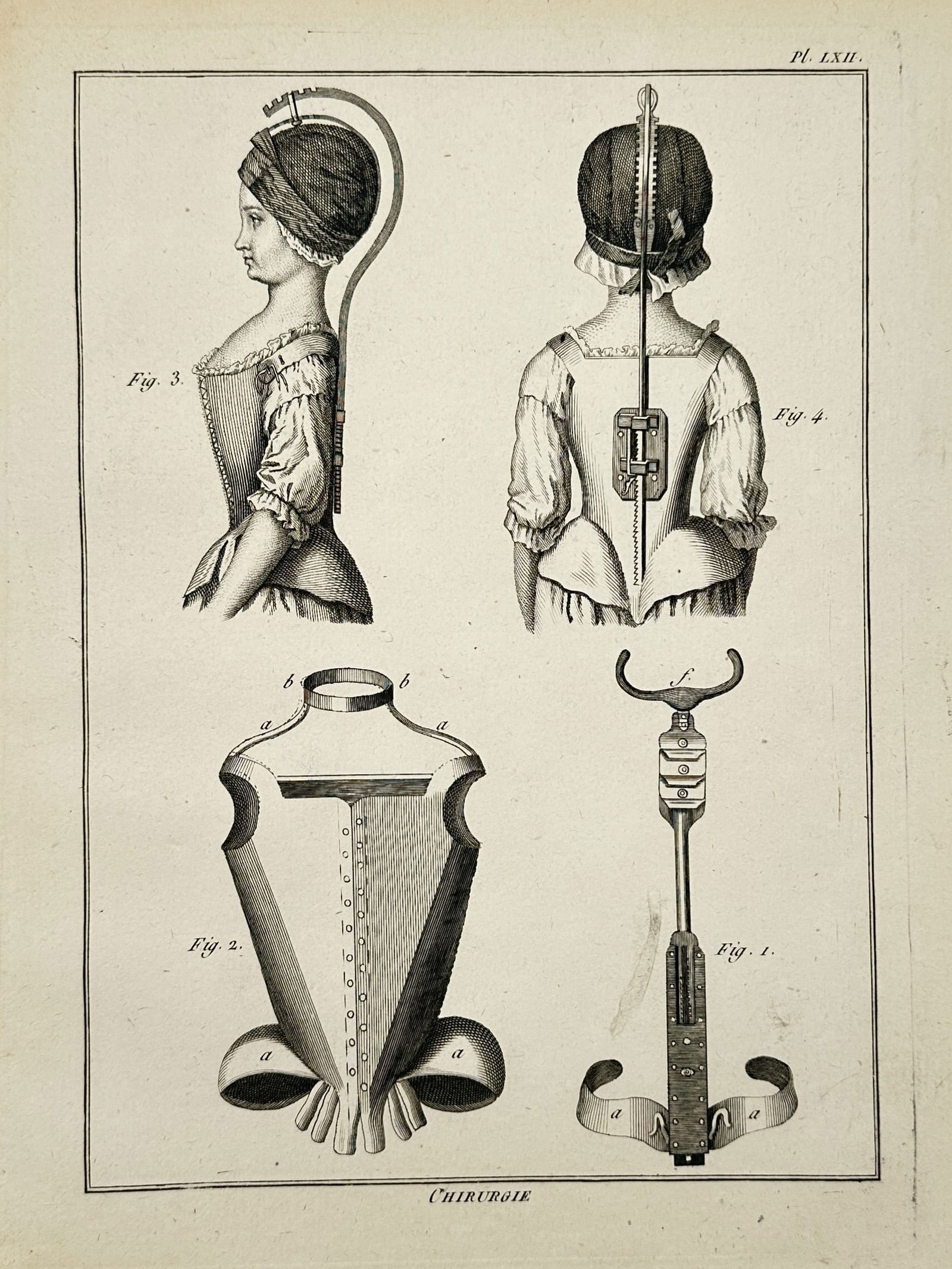Robert Bénard (1734–1777) – Technical Illustration of Orthopaedic Braces and Bodices (1 of 3)
