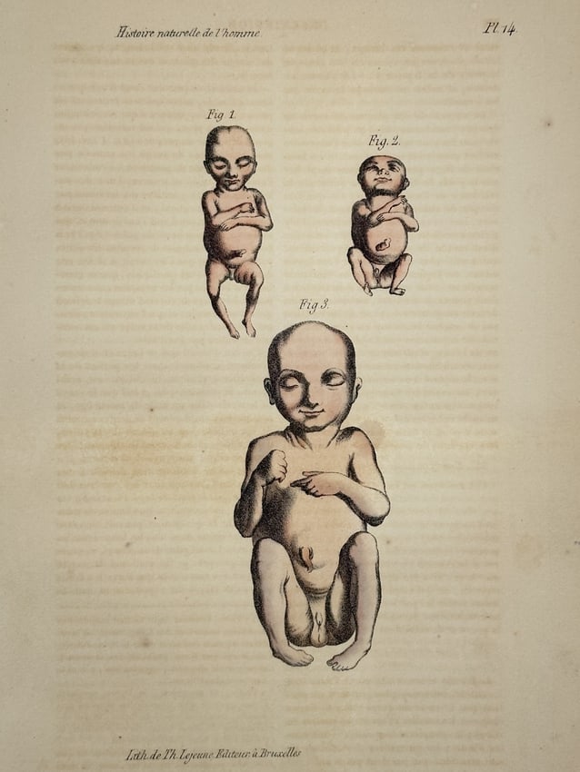Georges-Louis Leclerc, Comte de Buffon – Developmental Studies of the Fetus (1 of 2)