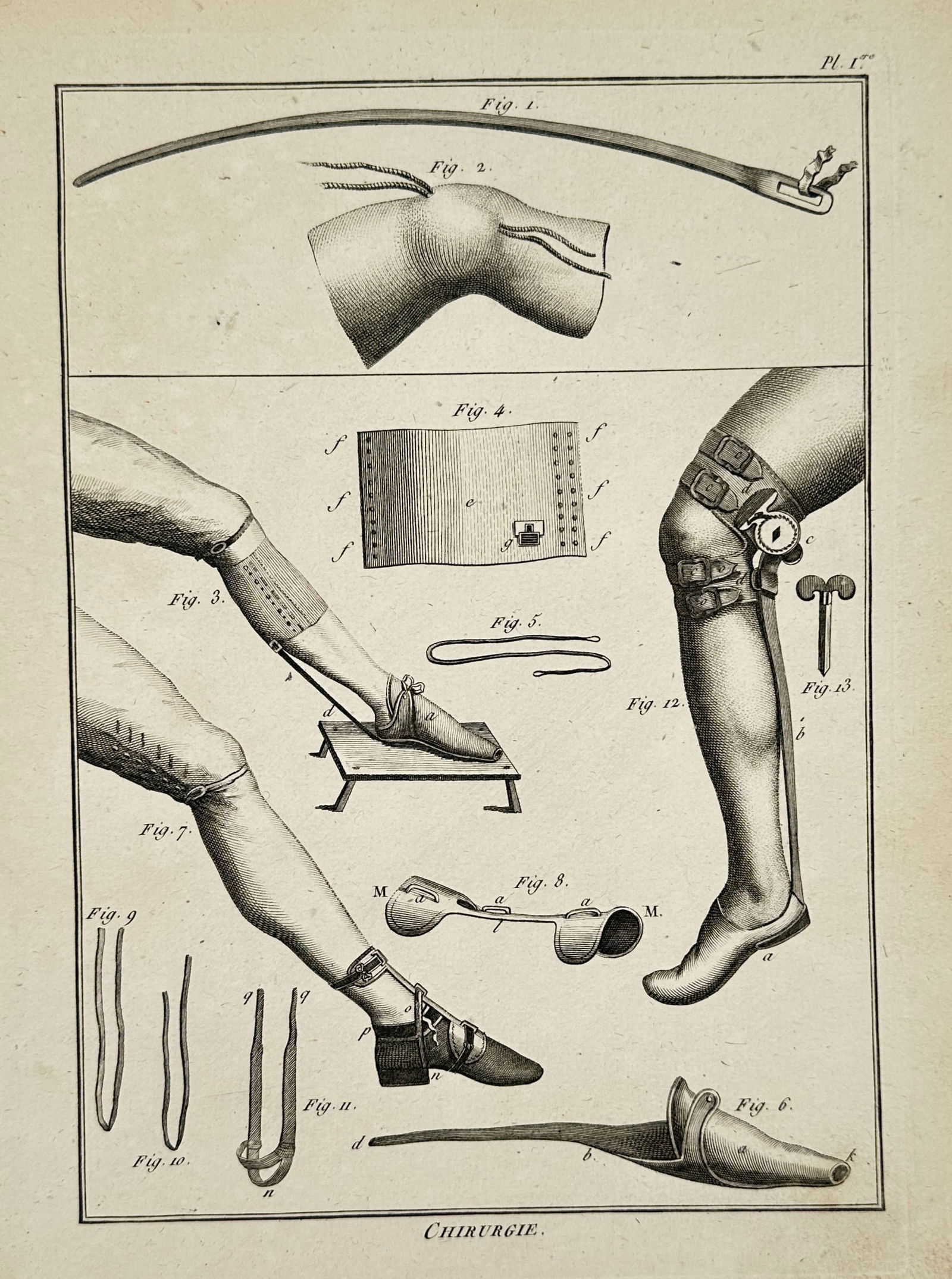 Robert Bénard (1734–1777) – Medical Illustration of Orthopedic and Surgical Apparatus (1 of 2)