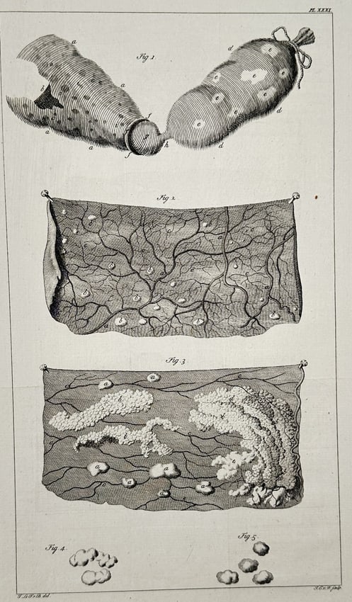 Richard Polydore Nodder – Study of Two Striped Conches/Whelks – Engraving: This engraving, comprising five figures, displays highly detailed anatomical studies of minute structures, likely illustrating tubular organs, reticulated vascular networks, and associated glands. The