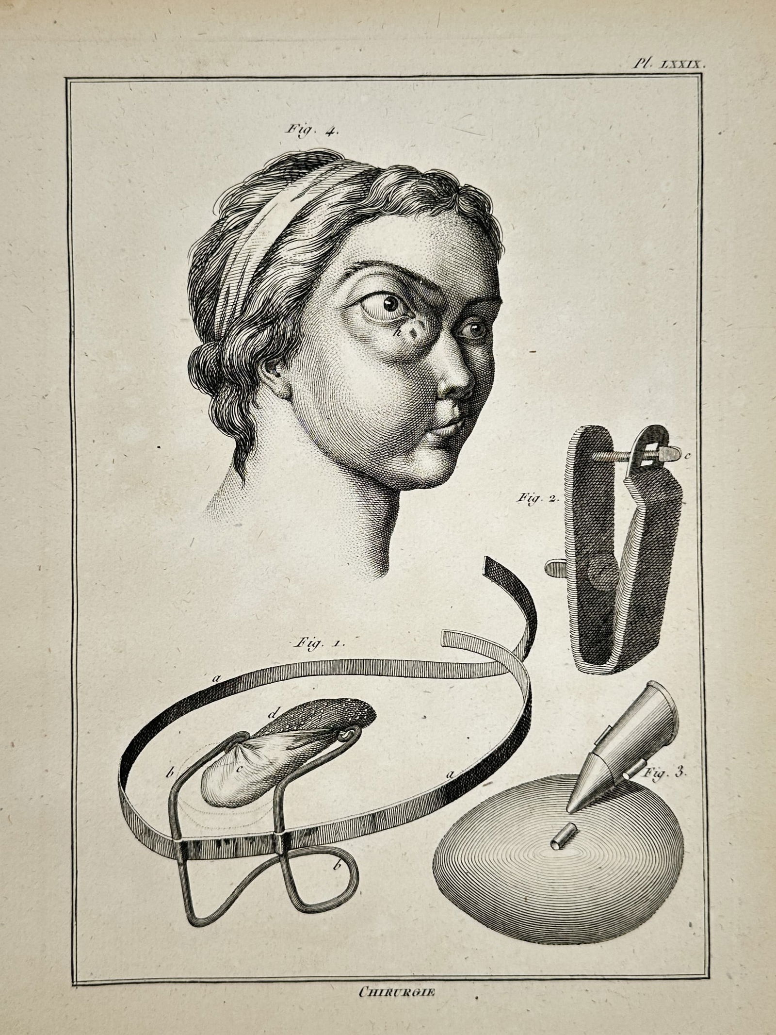 Robert Bénard (1734–1777) – Technical Study of Ophthalmic Pathology and Surgical (1 of 2)