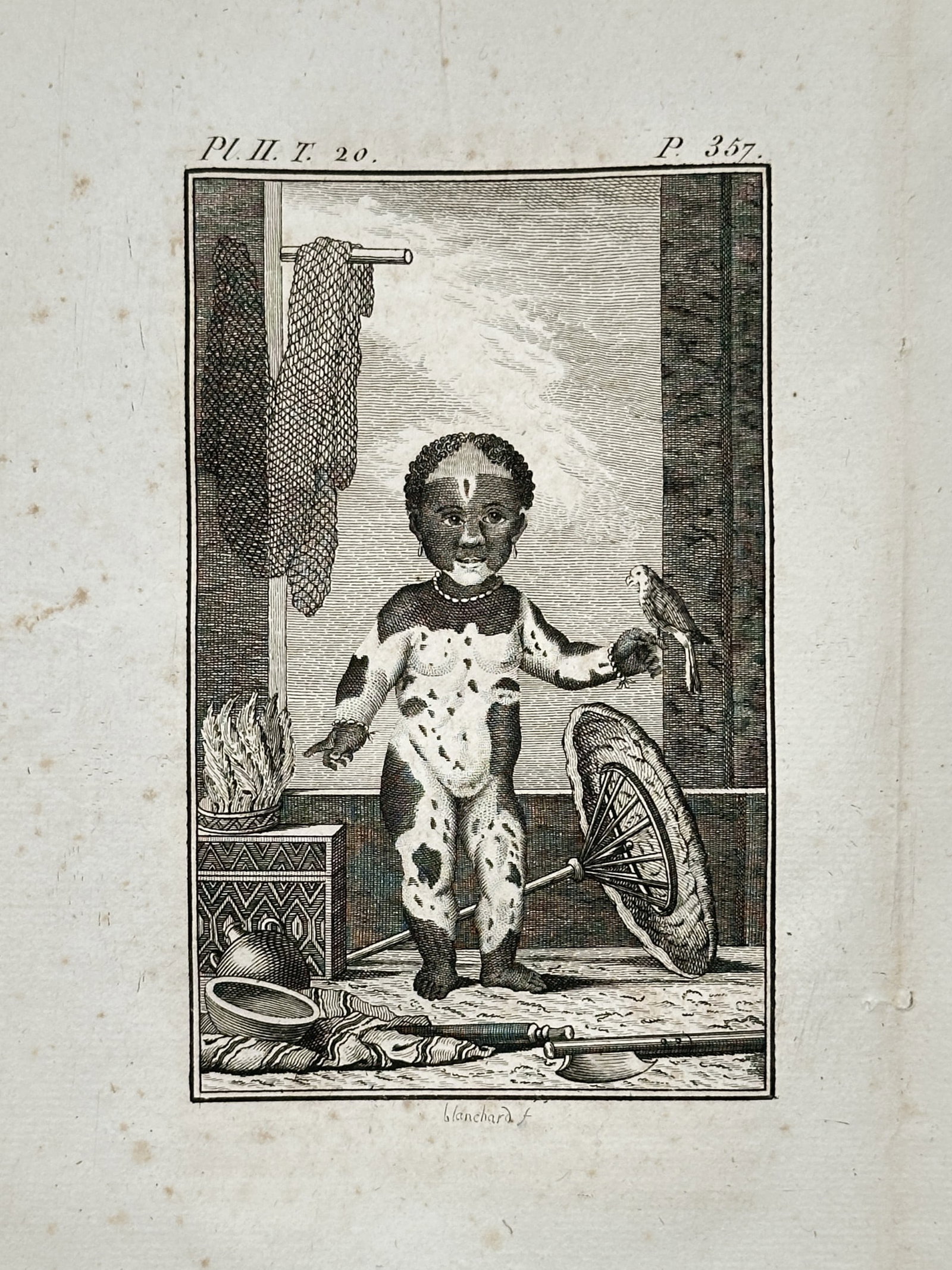 Georges-Louis Leclerc, Comte de Buffon – Anthropological Study of a Piebald Child – Engraving (1 of 2)