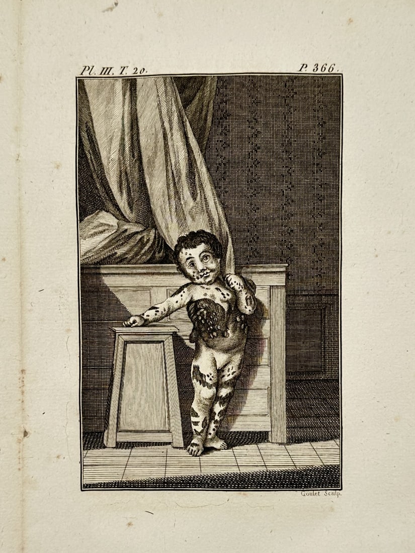 Georges-Louis Leclerc, Comte de Buffon – View of a Piebald Child – Hand-coloured engraving (1 of 2)