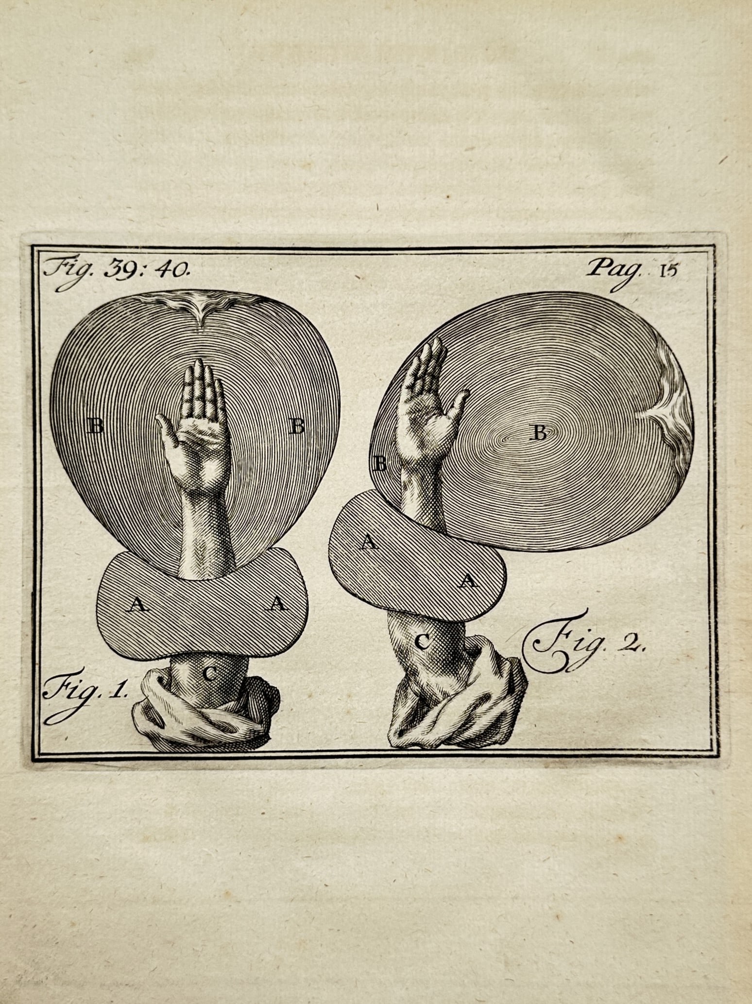 Hendrik van Deventer (1651–1724) – Obstetrical Studies of the Uterus and Birth Canal (1 of 2)