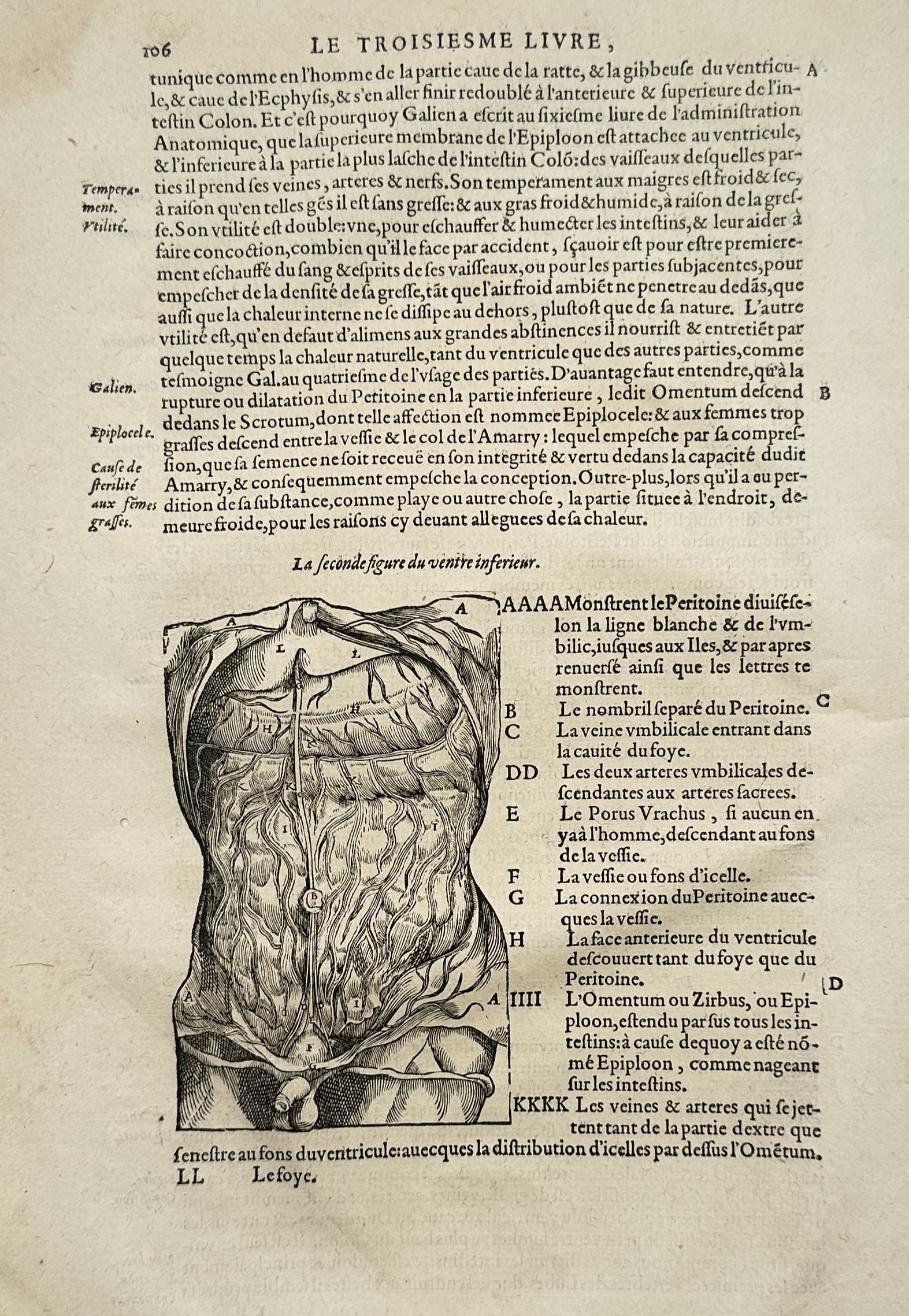 Ambroise Paré (1510–1590) – Anatomical Study of the Peritoneum and Lower Abdomen (1 of 2)