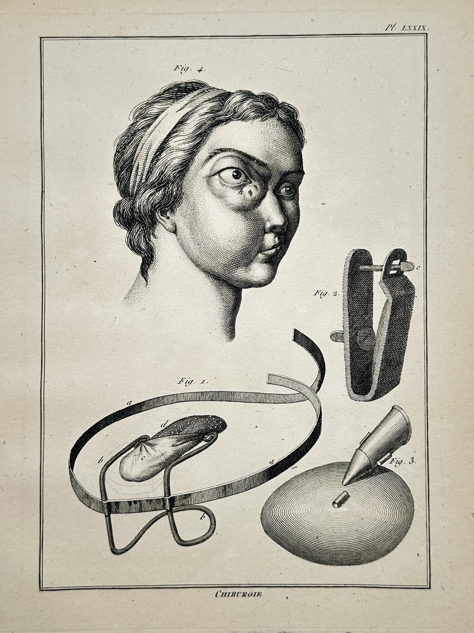 Denis Diderot – Medical Studies of Surgical Ophthalmology and Instruments – Engraving (ca. 1765) (1 of 2)