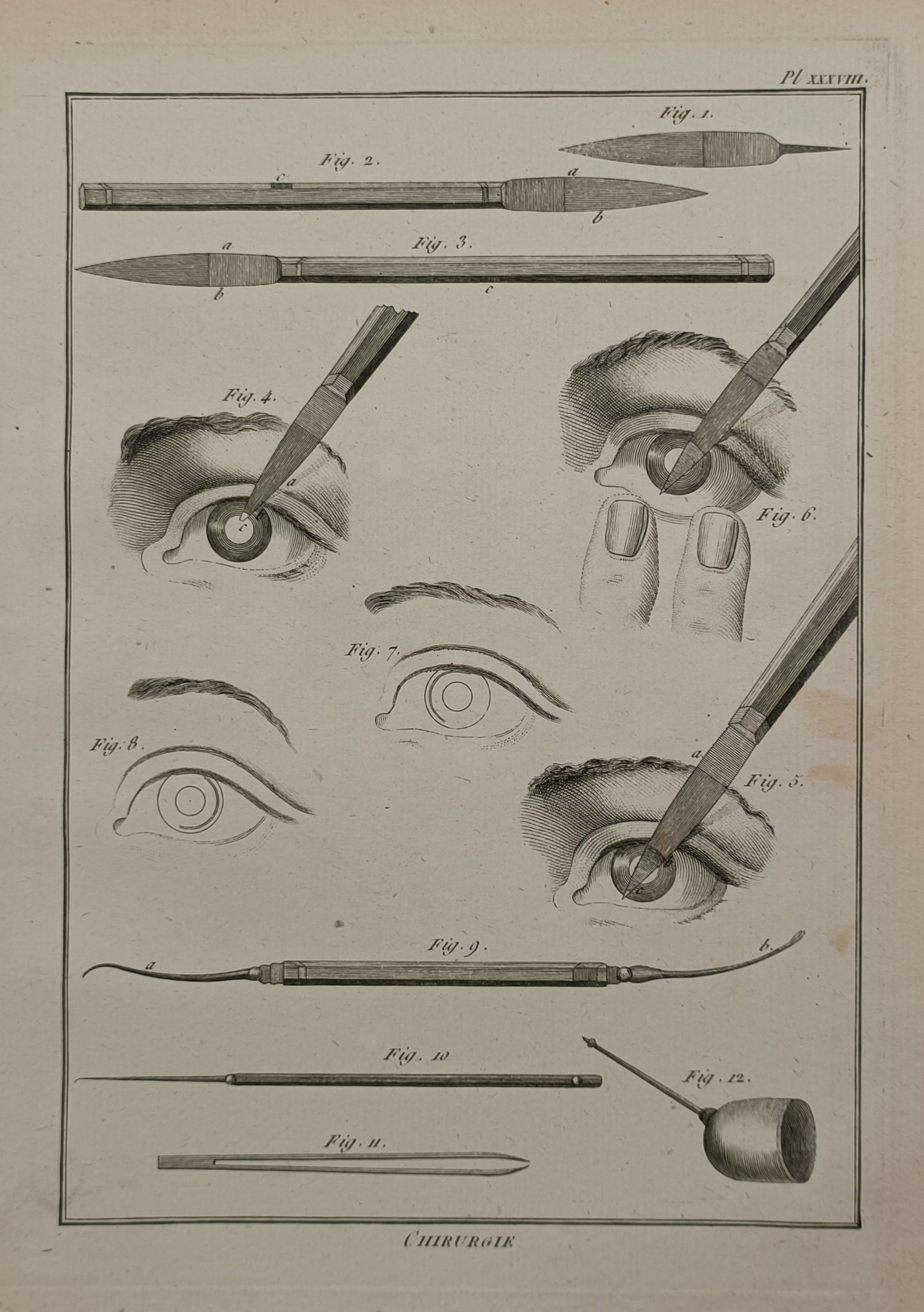 Denis Diderot (1713–1784) – Chirurgie – Engraving (ca. 1765) (1 of 2)