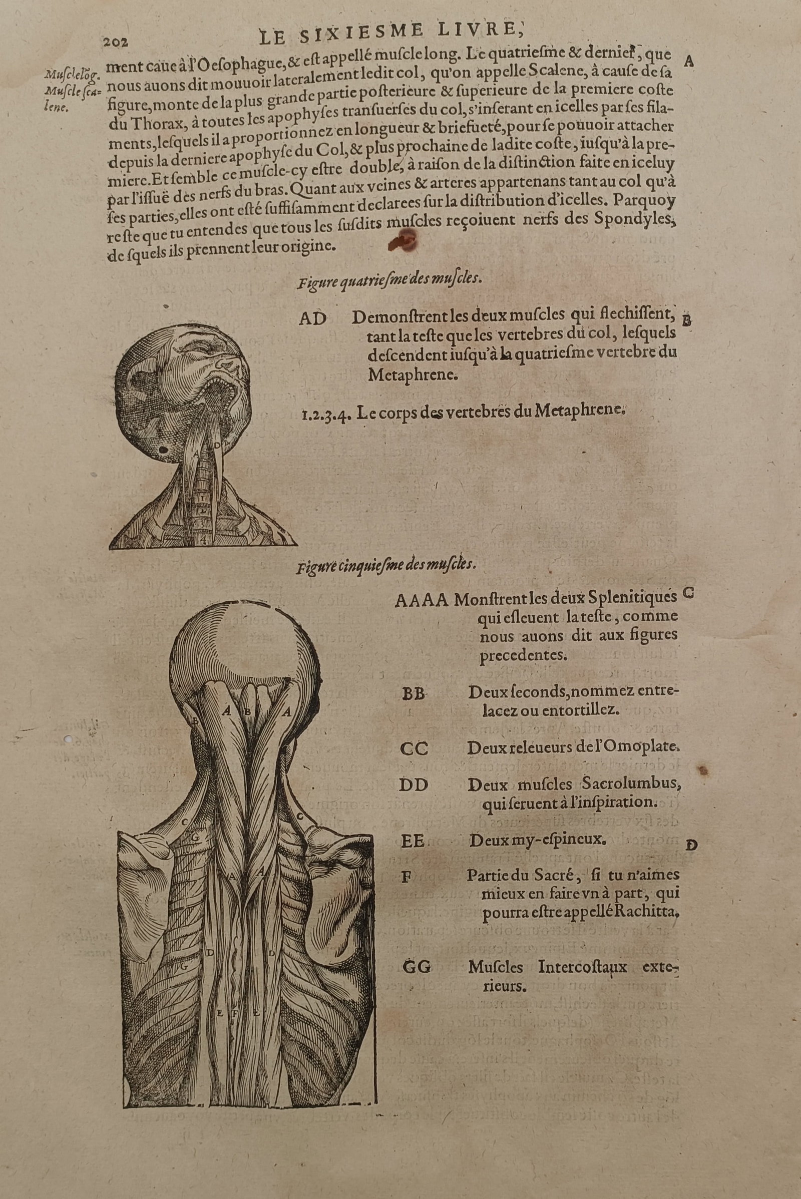 Ambroise Paré (c. 1510–1590) – Medical Study of the Neck and Back Muscles – Woodcut (1670) (1 of 2)