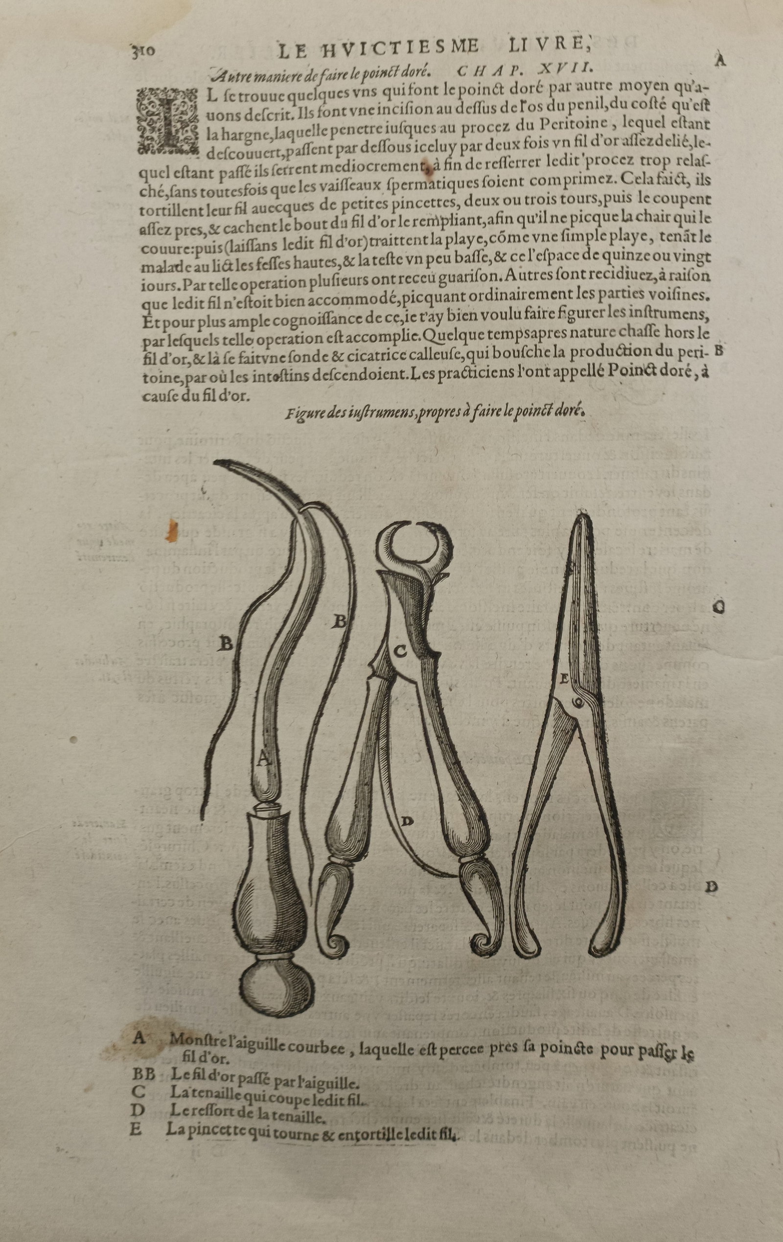 Ambroise Paré – Surgical Tools for the Golden Point Procedure – France – Woodcut (1585) (1 of 2)