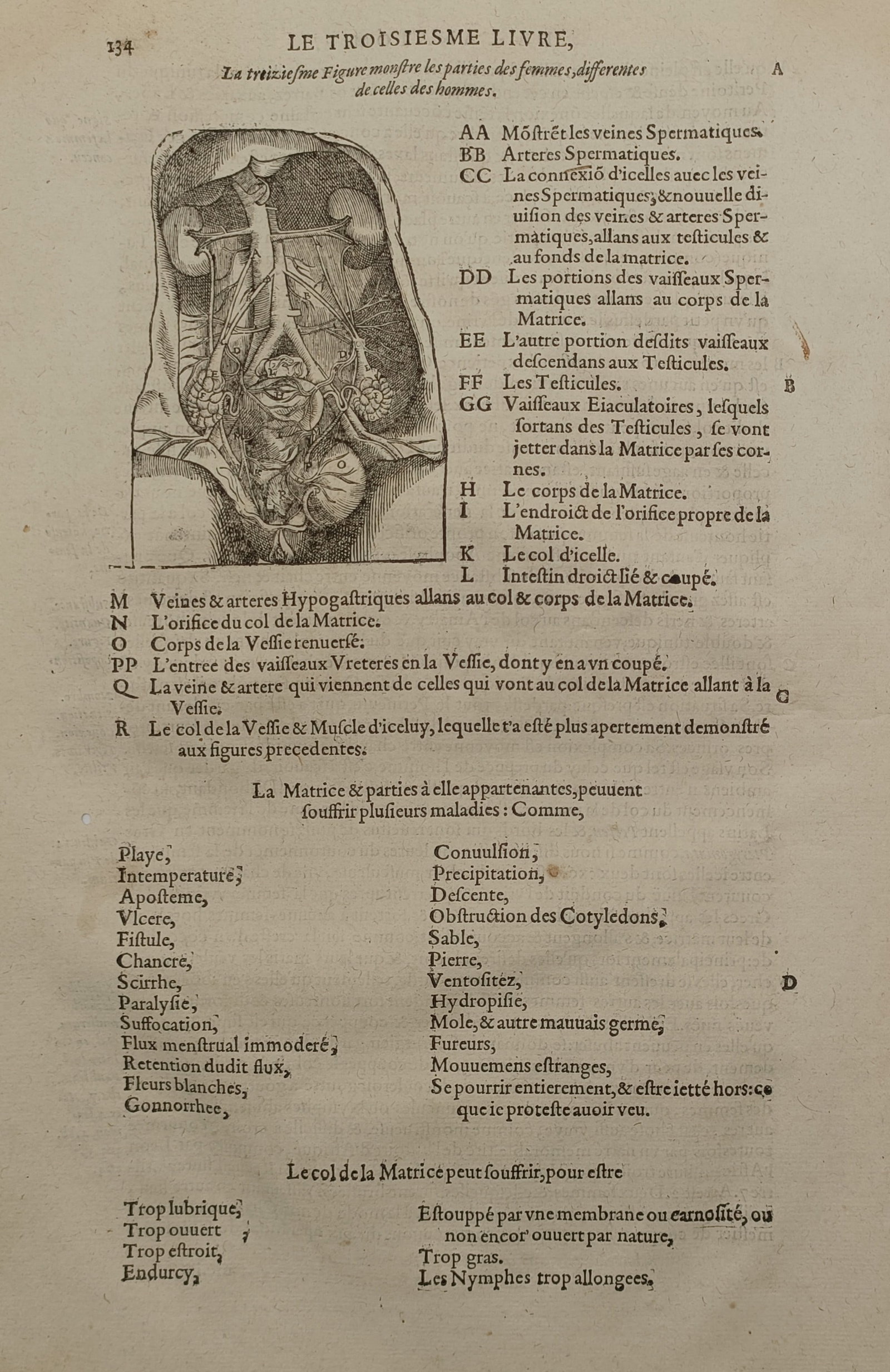 Ambroise Paré (1510 – 1590) – Female Reproductive Anatomy – Woodcut (1670) (1 of 2)