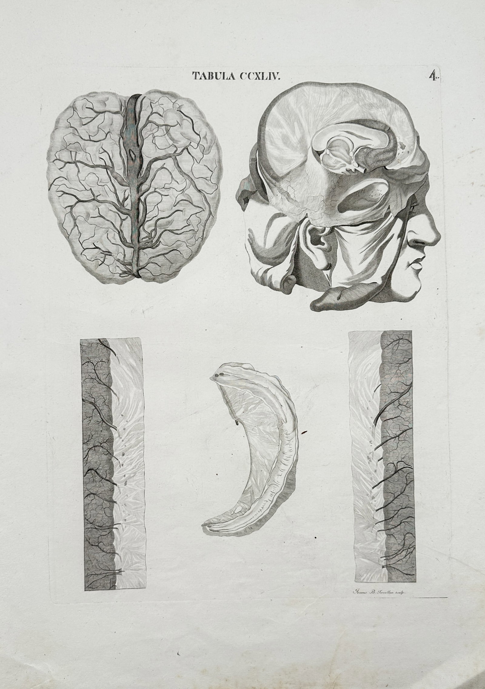 Joanes Baptista Forcellan – Anatomical Studies of the Human Brain and Cranium – Engraving: "Tabula CCXLIV" features a detailed medical overview illustrating various dissection views of the human brain, cranial vasculature, and structural cross-sections. This plate documents the precise reco