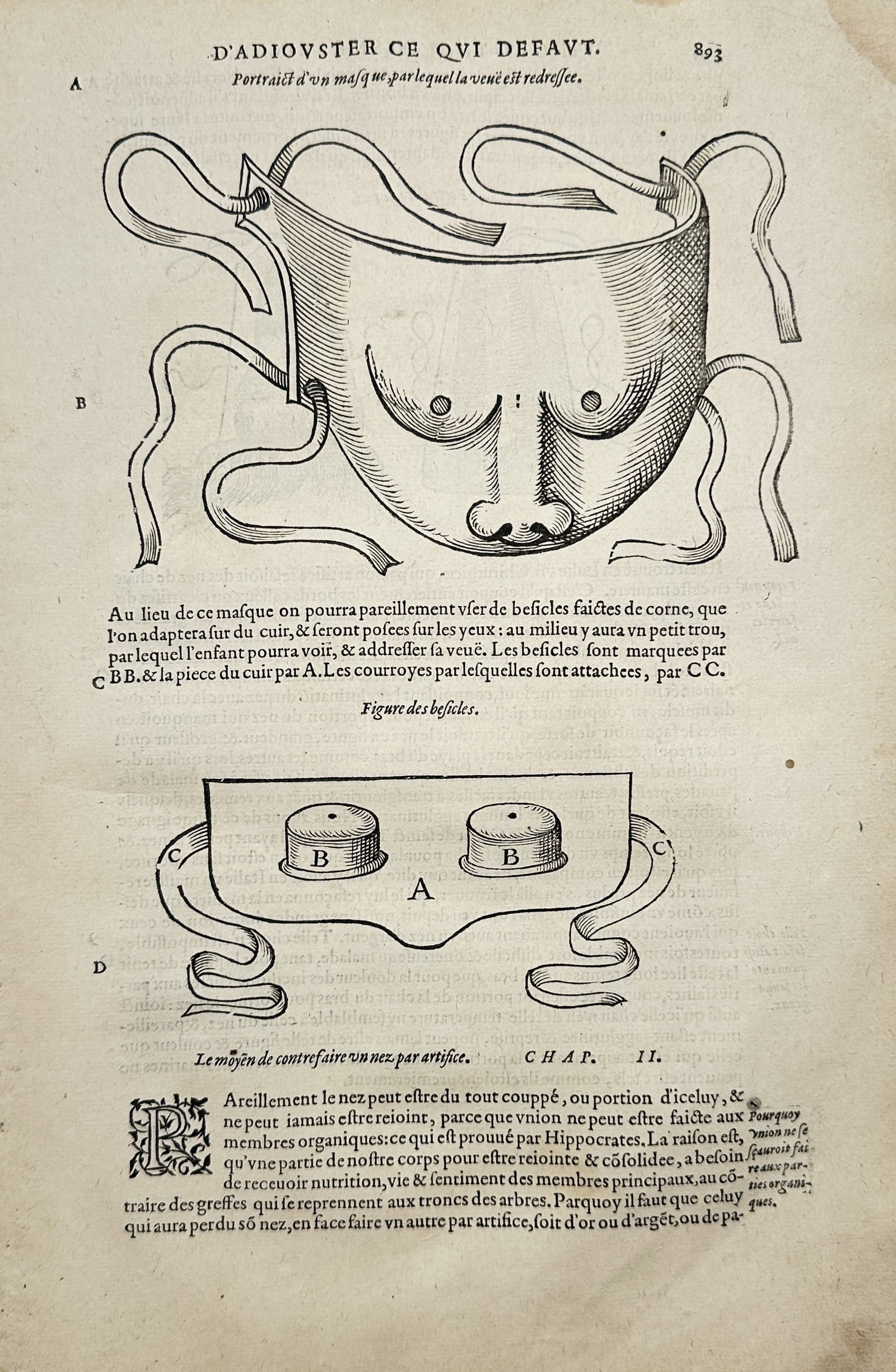 Ambroise Paré – Medical Mask and Spectacles for Vision Correction – Woodcut (16th Century) (1 of 2)