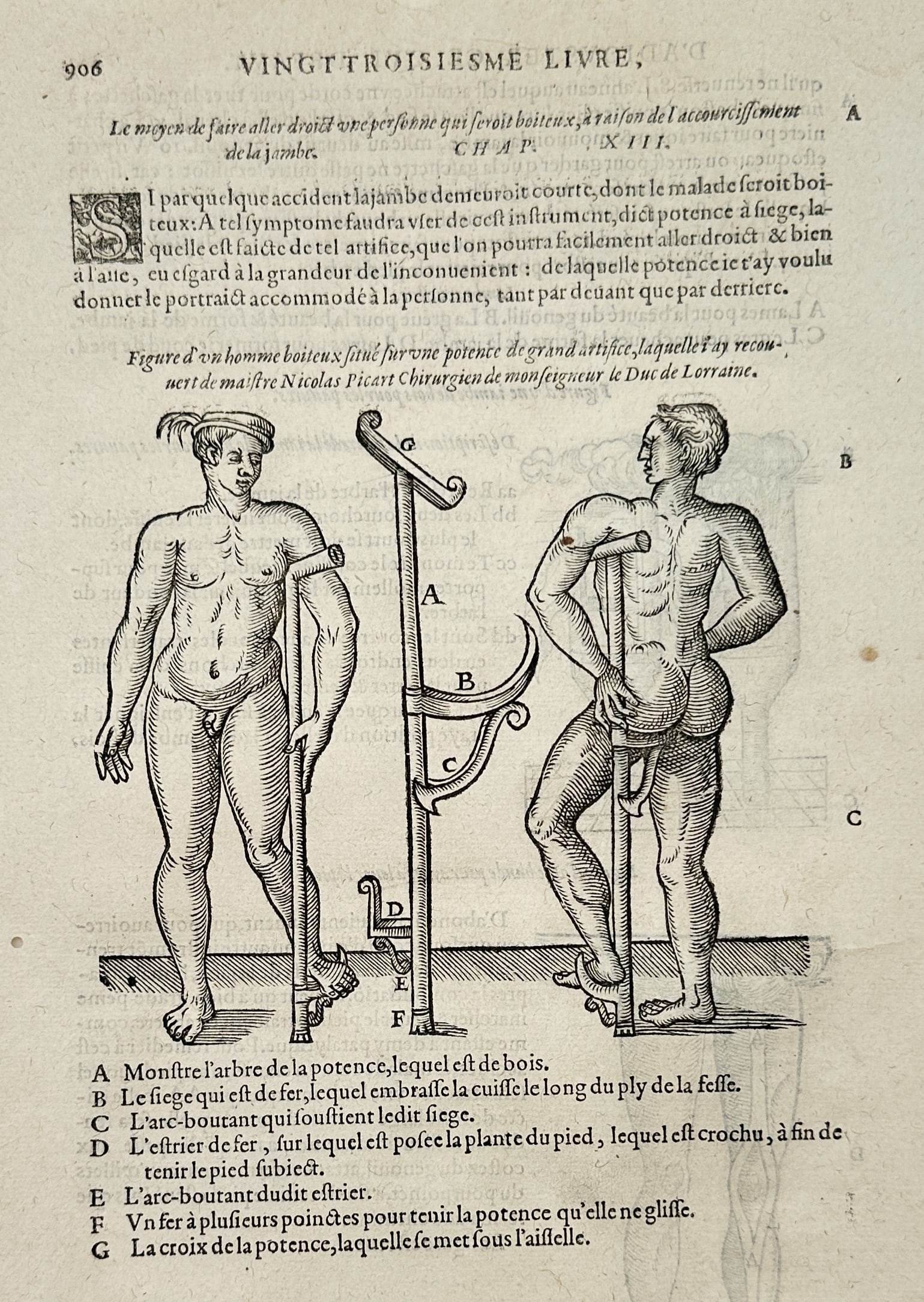 Ambroise Paré – Method for Enabling a Lame Person to Walk – Woodcut (16th Century) (1 of 2)