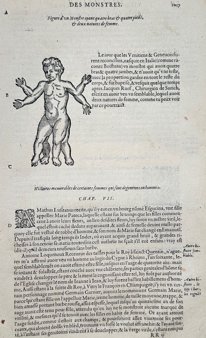 Ambroise Pare – Study of a Conjoined Monster – Woodcut (16th Century): "Of Monsters" This medical print illustrates a scientific study of a conjoined child with multiple limbs accompanied by columns of early French text discussing anomalies and natural wonders. The work 