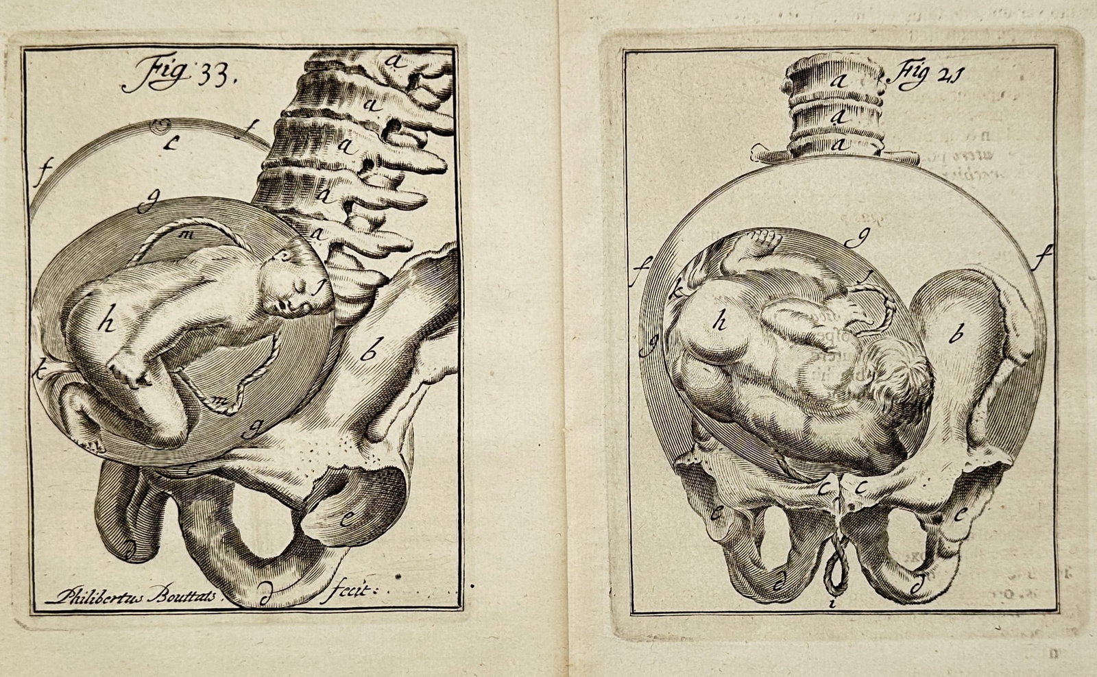 Denis Diderot – Set of 2: Anatomical Studies of Foetal Development in the Womb – Engravings (1 of 2)