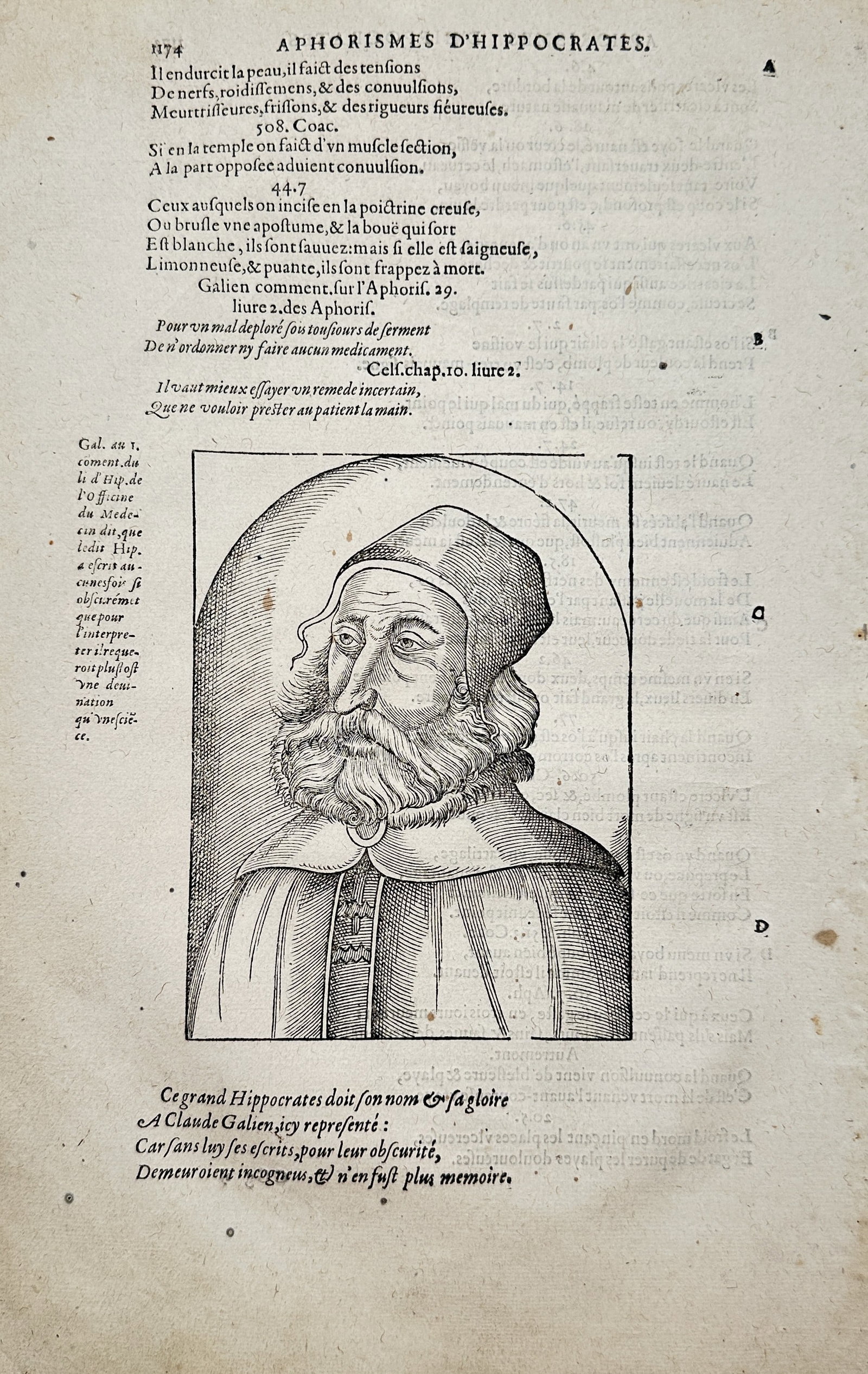 Ambroise Paré – Portrait of Galen and Aphorisms of Hippocrates – Engraving (16th Century): "Aphorisms of Hippocrates" presents a historical medical portrait depicting the Greek physician Galen with a cap and beard set alongside printed commentary on ancient medicine and surgical aphorisms. 