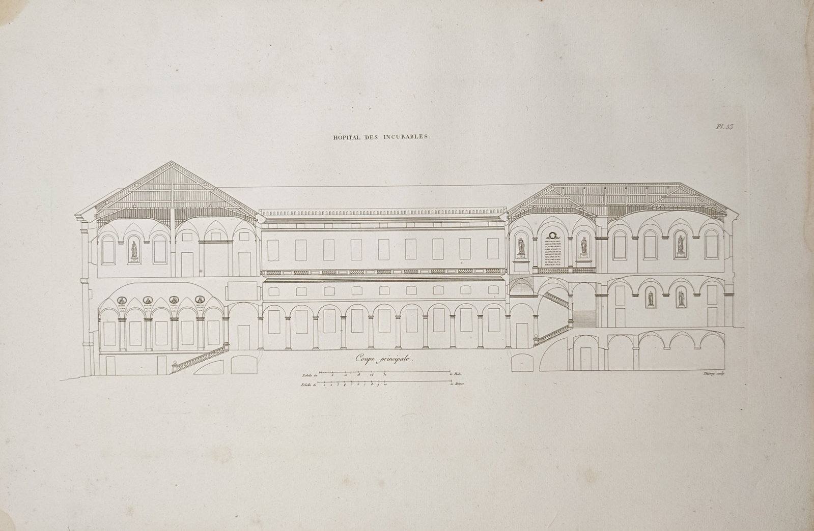Étienne-Jules Thierry – Architectural Cross-Section of the Hospital of Incurables – Engraving (1 of 2)