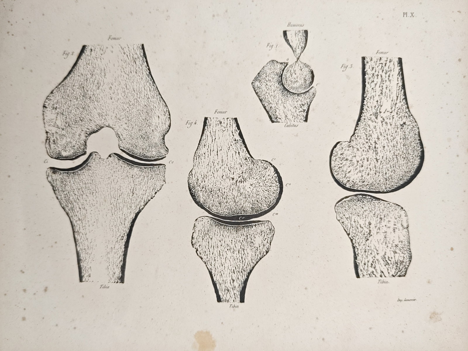 Samuel Thomas von Soemmerring – Anatomical Studies of the Knee and Elbow Joints – Lithograph: "Anatomical Studies of the Knee and Elbow Joints" presents a comparative osteological study detailing cross sections and articulations of the human skeletal framework. Printed in Paris by the workshop