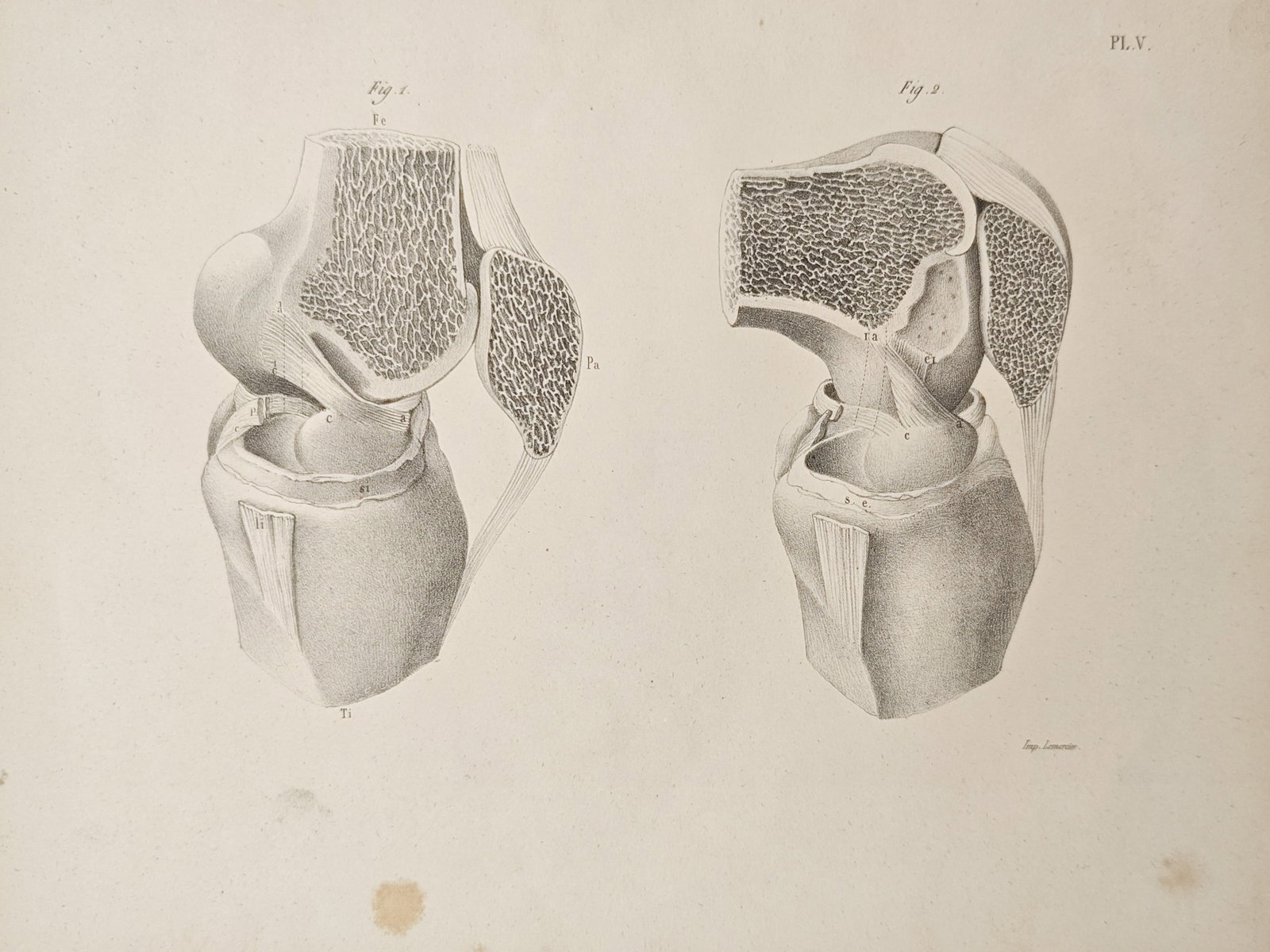 Henri Marie Ducrotay de Blainville – Comparative Osteological Study of the Knee Joint and (1 of 2)
